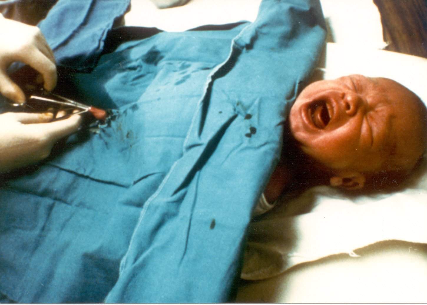 Att skära i barn är inte en rättighet